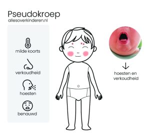 pseudokoep